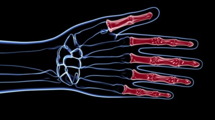 Human Skeleton Hand Phalanges Bone Anatomy For Medical Concept