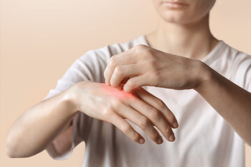 Woman scratching her arm with nails. Dry skin, animal or food allergy, dermatitis, insect bites, irritation concept.