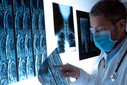 Radiologist doctor examining spinal column by radiography, x-ray and magnetic resonance in hospital. Radiology clinical diagnosis.