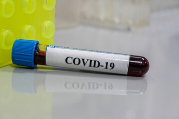 Coronavirus test.