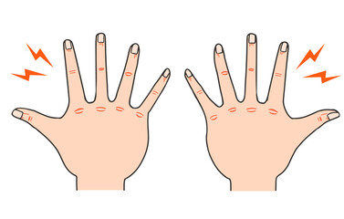 Obraz premium 手 あかぎれ