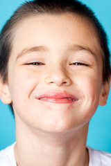 Portrait of a cheerful smiling boy with mild perioral dermatitis on a blue background