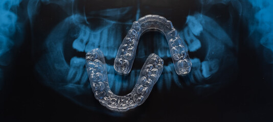 Transparent bite correction trays and x-ray of the jaw. Orthodontist equipment - obrazy, fototapety, plakaty