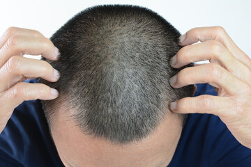 Fototapeta premium Gray hair problems in men, asian man with gray hair, white hair or hair loss problem.