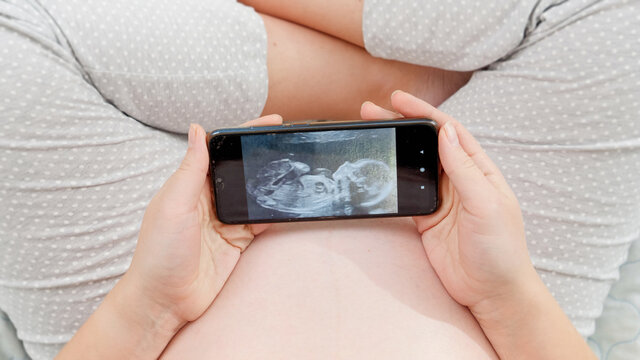 Top view of pregnant woman sitting on bed and looking on ultrasound image of her unborn baby on smartphone