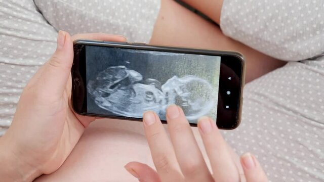 CLoseup of ultrasound image of unborn baby on smartphone screen. Concept of expecting baby, pregnancy and healthcare.
