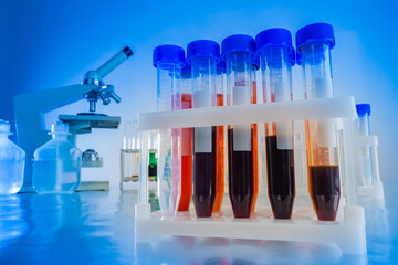 Rack with blood tubes on the table. Plastic test tubes with human blood. Laboratory table with...