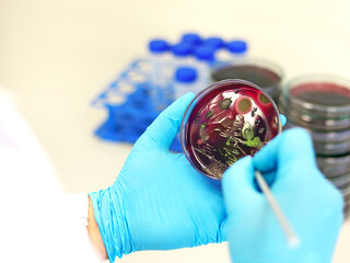 Scientist analysis Escherichia coli (E.coli) culture with Eosin Methylene Blue (EMB) Agar in Petri...