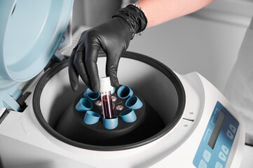 Plasmolifting process. Preparation of blood for injections. Cosmetologist in black rubber glove puts tube of blood in centrifuge. Concept of beauty and health