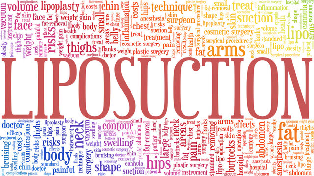 Liposuction vector illustration word cloud isolated on a white background.	