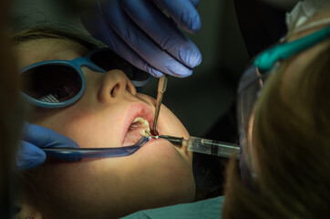 Children's dentist treats baby teeth	
