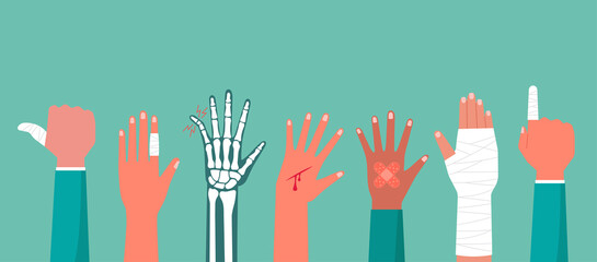 Concept of the human hand trauma injury with X-ray of broken bone, cutting wound red blood on palm, the bandage on finger, arm pain, vector flat illustration
