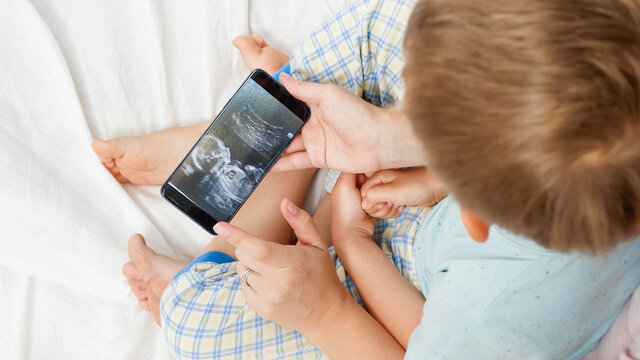 Closeup of young woman showing baby ultrasound image to her little son on smartphone. Concept of healthcare and family happiness expecting baby