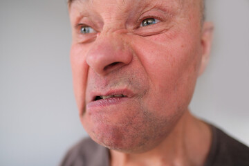 face of a European old man close-up, wrinkles on the aging skin, bares his teeth, makes grimaces, opening his mouth, the concept of mental health, cosmetology, age-related changes