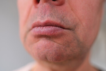 close-up and front view of mouth of an old caucasian man in his sixties, with strong wrinkles, bright emotions on his face, male skin care concept