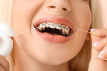 Young woman with dental braces and floss, closeup