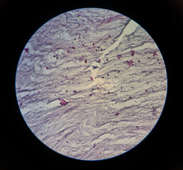 microbiology fibrocartilage microscope