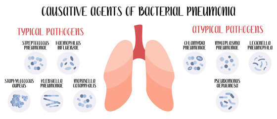 Causative agents of bacterial pneumonia. Acute respiratory tract infections. Typical and atypical pathogens (cocci, bacilli). Morphology. Microbiology. Vector flat illustration - 404807935
