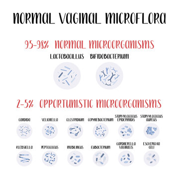 Normal vaginal microflora, lactobacillus, bifidobacterium. Normal and opportunistic pathogenic microorganisms, infection. Female reproductive system. Gynecology. Vector flat cartoon illustration