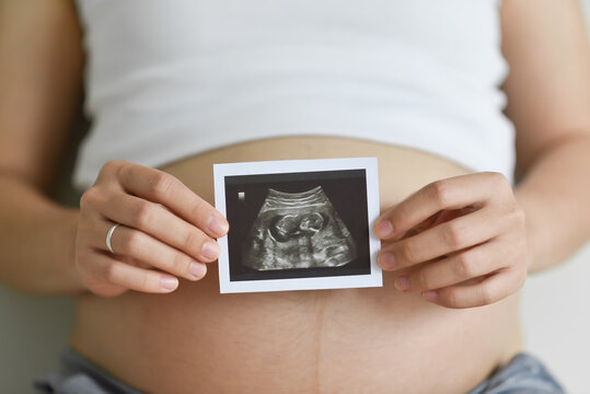 Pregnant woman holding ultrasound scan photo on her belly. Mother with sonogram of her unborn baby.