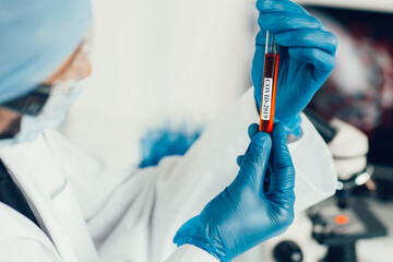 tube with the tested test in the hands of a laboratory assistant .