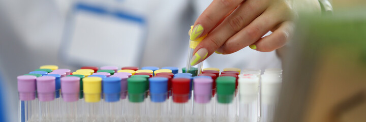 Close-up of laboratory assistant hand holding test-glass. Tubes with multicolored lids with dna in stand. Results of experiments. Analysis and chemistry concept