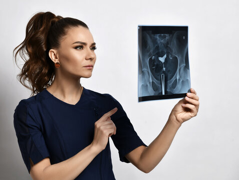 Portrait of young serious brunette woman doctor gynecologist in blue medical uniform looking and pointing at X-ray of pelvis over light background. Gynecology, healthcare, medical research concept