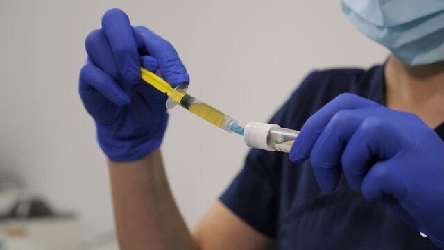 The doctor in blue gloves collects plasma from blood in the syringe for injection of plasma therapy Regeneration of body cells Germination of new vessels. Restoration of blood supply.