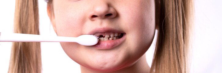 Fototapeta premium Preschool girl with first adult incisors and a toothbrush. The milk tooth has fallen out, and a permanent tooth grows in the open mouth. Dental hygiene concept