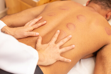 Fototapeta na wymiar Terapeuta fazendo massagem nas costas de paciente com marcas de terapia com ventosa.