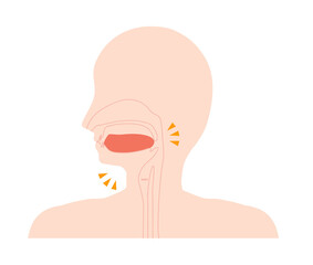 低位舌のイラスト