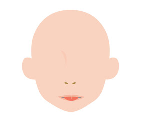 舌小帯短縮症で伸ばせない舌のイラスト　