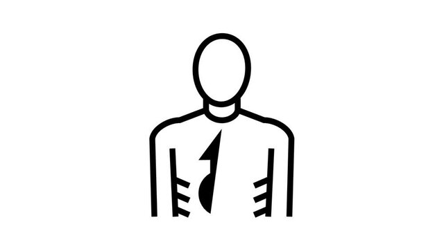 anorexia psychological disease animated black icon. anorexia psychological disease sign. isolated on white background