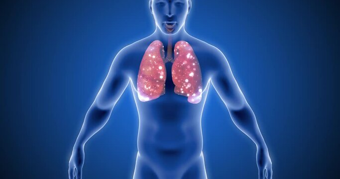 Human body X ray 3D rendering, Virus penetration, Pneumonia, Lungs, Infection, Cold, Flu, Coronavirus Covid-19, SARS-CoV-2 Virus, Infecting Human Cells, SARS, MERS
