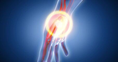 Pain in the arm, pain in the fingers, human skeleton, bone scan, joint, medical screen 3D render, human anatomy, computer anatomy, body skeleton, X-ray scan