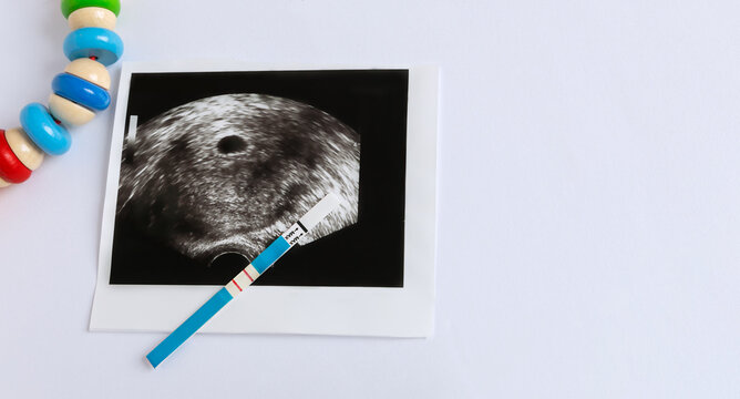 Photo of ultrasound of the first weeks of pregnancy, positive pregnancy test and wooden baby toy on a white background with copy space. Planning and expecting a baby.