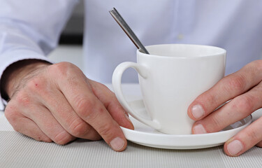 Dry, chapped and cracked male hands close up, winter skin care concept