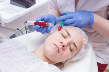 The process of mesotarpia with the introduction of serum under the skin
