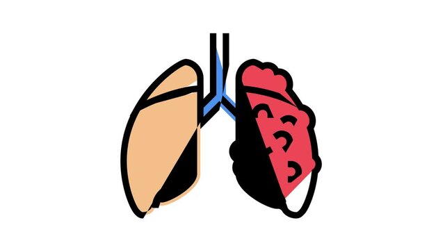 ards respiratory disease animated color icon. ards respiratory disease sign. isolated on white background