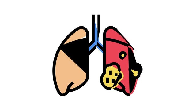 acute respiratory distress syndrome animated color icon. acute respiratory distress syndrome sign. isolated on white background