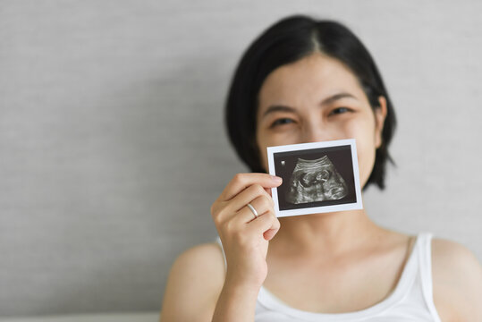 Happy Smiling Young Asian Pregnant woman holding showing ultrasound scan photo.