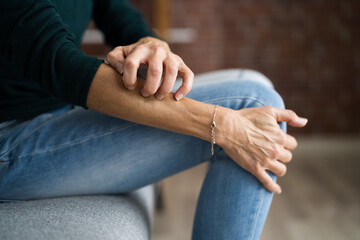 Woman Scratching Itching Body Skin