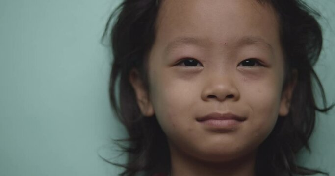 4K Slow motion Asian little girl face, swollen eyes due to mosquito allergy, background green pastel 