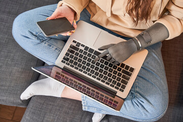 Girl with prosthesis hand typing on laptop information from smartphone