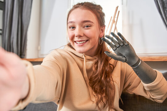 Woman with artificial limb making selfie photo