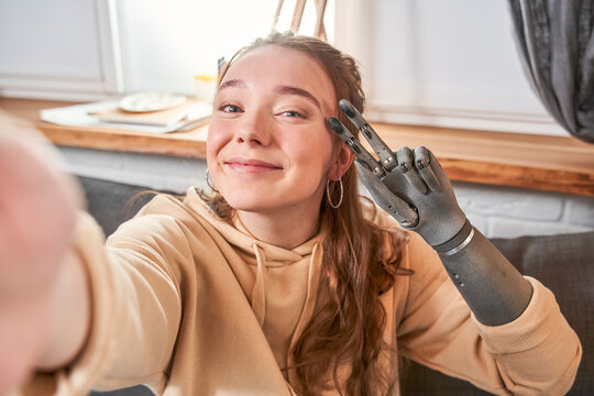 Woman with artificial limb making selfie photo