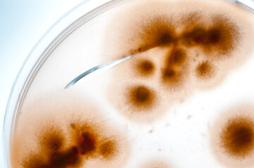 image of bacteria in laboratory placed in a receptacle