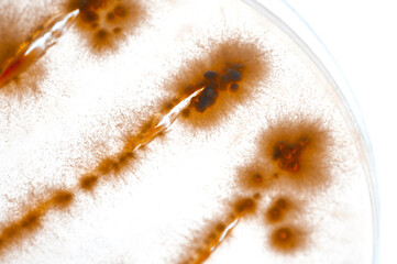 image of bacteria in laboratory placed in a receptacle
