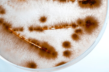 image of bacteria in laboratory placed in a receptacle