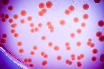 image of bacteria in laboratory placed in a receptacle